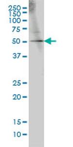 GABPA Antibody in Western Blot (WB)