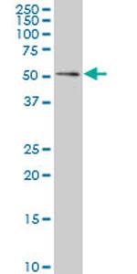 GABPA Antibody in Western Blot (WB)