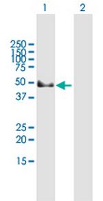 GAK Antibody in Western Blot (WB)