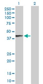 B4GALNT1 Antibody in Western Blot (WB)