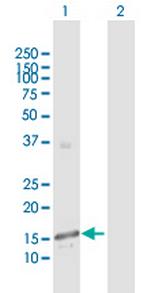 GALNT3 Antibody in Western Blot (WB)