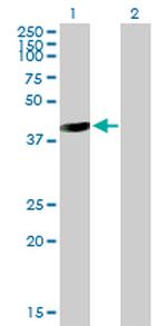 GALT Antibody in Western Blot (WB)