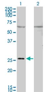 GAP43 Antibody in Western Blot (WB)