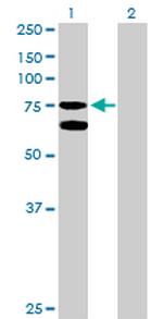 GARS Antibody in Western Blot (WB)