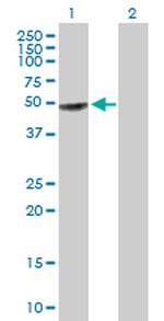 GART Antibody in Western Blot (WB)