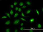 GART Antibody in Immunocytochemistry (ICC/IF)