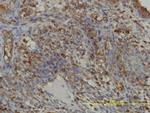 GART Antibody in Immunohistochemistry (Paraffin) (IHC (P))