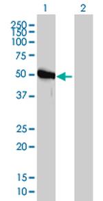 GART Antibody in Western Blot (WB)