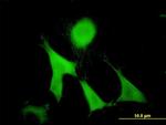 GAS2 Antibody in Immunocytochemistry (ICC/IF)