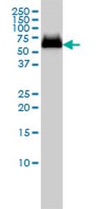 GBA Antibody in Western Blot (WB)