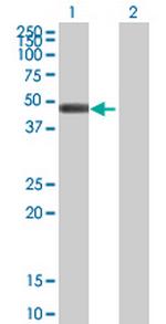 GCDH Antibody in Western Blot (WB)