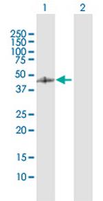 GCDH Antibody in Western Blot (WB)