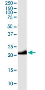 GCG Antibody in Western Blot (WB)