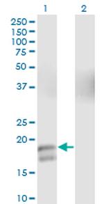 GCG Antibody in Western Blot (WB)