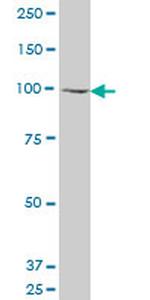 GCN5L2 Antibody in Western Blot (WB)