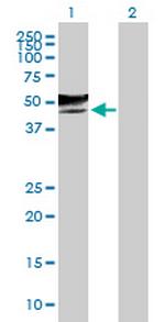 GCNT2 Antibody in Western Blot (WB)