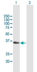 GEM Antibody in Western Blot (WB)