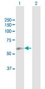 GGTLA1 Antibody in Western Blot (WB)