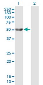 GK Antibody in Western Blot (WB)