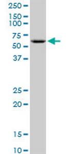 GK2 Antibody in Western Blot (WB)