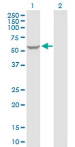 GK2 Antibody in Western Blot (WB)