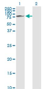 GLB1 Antibody in Western Blot (WB)