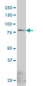 GLB1 Antibody in Western Blot (WB)