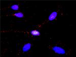 GLI3 Antibody in Proximity Ligation Assay (PLA) (PLA)