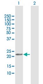 GLO1 Antibody in Western Blot (WB)