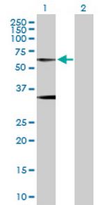 GLRA1 Antibody in Western Blot (WB)