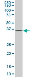 GLUL Antibody in Western Blot (WB)