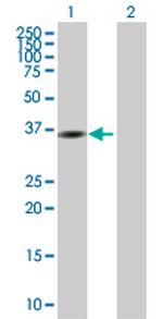 GMPR Antibody in Western Blot (WB)