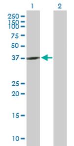 GNAQ Antibody in Western Blot (WB)