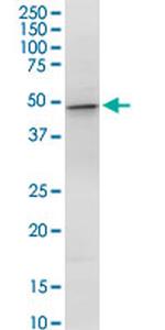 GOT1 Antibody in Western Blot (WB)