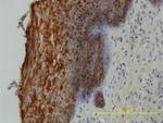 SFN Antibody in Immunohistochemistry (Paraffin) (IHC (P))