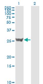 SFN Antibody in Western Blot (WB)