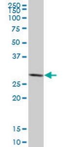 SFN Antibody in Western Blot (WB)