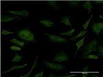 SFN Antibody in Immunocytochemistry (ICC/IF)