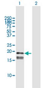 GP9 Antibody in Western Blot (WB)