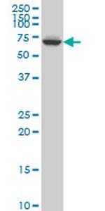 GRK6 Antibody in Western Blot (WB)