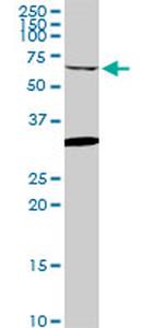 GRK6 Antibody in Western Blot (WB)