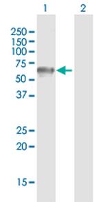 GPS1 Antibody in Western Blot (WB)