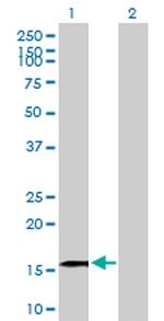 GRIN2C Antibody in Western Blot (WB)