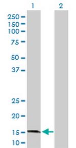 GRIN2C Antibody in Western Blot (WB)