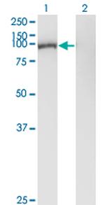 GSN Antibody in Western Blot (WB)