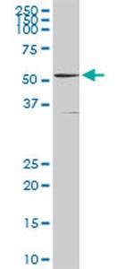 GSR Antibody in Western Blot (WB)