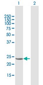 GSTA1 Antibody in Western Blot (WB)