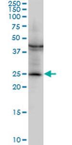 GSTM2 Antibody in Western Blot (WB)