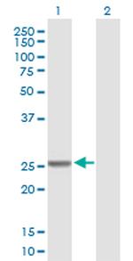 GSTM4 Antibody in Western Blot (WB)