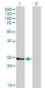 GSTM4 Antibody in Western Blot (WB)